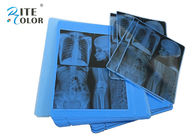 Dikte van de de Weergavefilm 210um van de radiologie de Blauwe Röntgenstraal Medische voor de Printer van Epson Inkjet