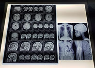 Maak 215 Micron HUISDIER Gebaseerd Medisch X Ray Film waterdicht