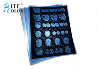 Plastic Duidelijk Inkjet Medisch X Ray Film Waterproof Blue Color 215mic