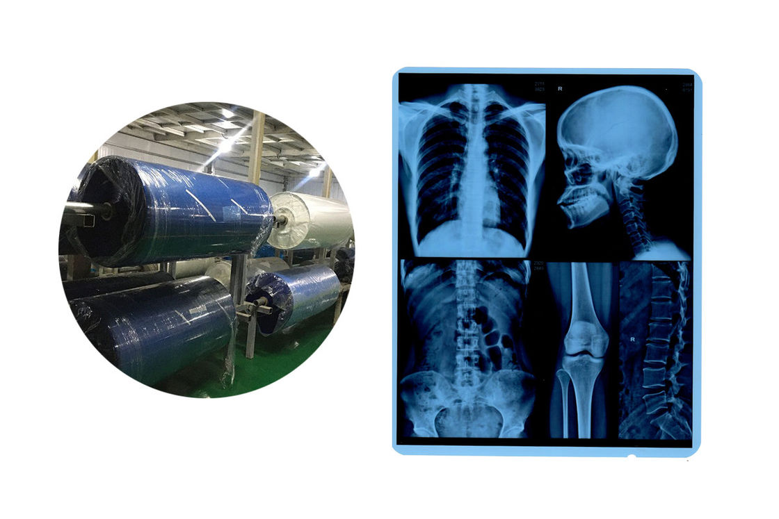 8x10 210 Micron Blauwe Basis X Ray Medical Imaging Film
