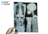 10 * van de de Weergavefilm van het 12 Duimhuisdier Medische Droge de Röntgenstraalfilm voor Inkjet-Printers
