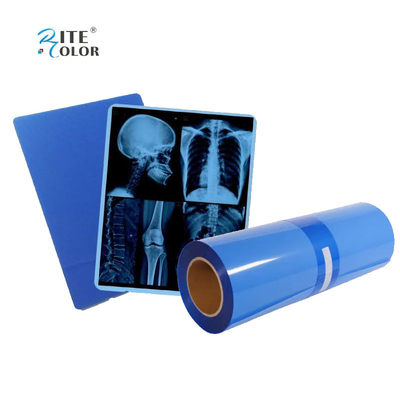 IMATEC Blue PET Inkjet Medical CR Röntgenfilm voor Canon-printers