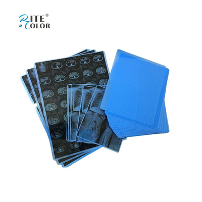 Inkjetprinting PET blauwe medische film voor röntgen A4 8x10 14x17 vellen
