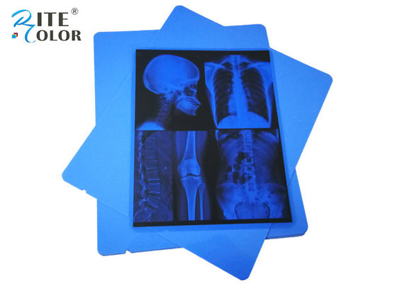 Low Fog A4 Blue PET Dry Pigment Inkjet 210 Micron Medische X-Ray Film Eco Friendly
