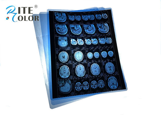 Waterdichte PET Blauwe medische röntgenfilm voor MRI CT CR Tandheelkundige panoramabeelden