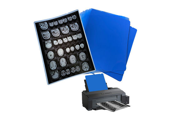 210um 8x10 A3 A4 Blauwe medische inkjetfilm voor radiologie Röntgenbeeldvorming